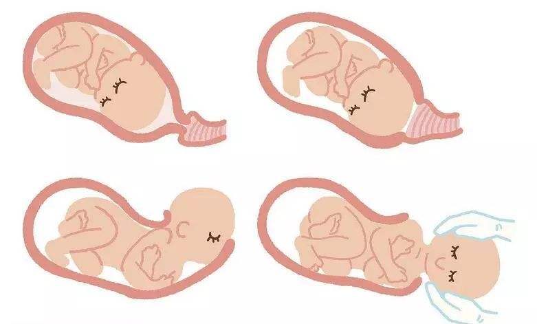 顺产后妈妈产道撕裂怎么护理,顺产妈妈产后为什么会发抖