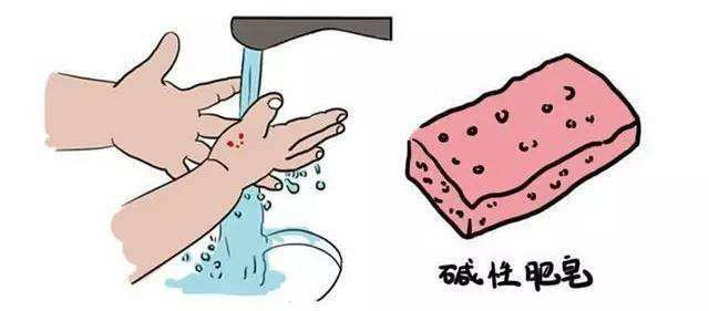 撸猫被咬打疫苗,撸猫撸了一会就咬人