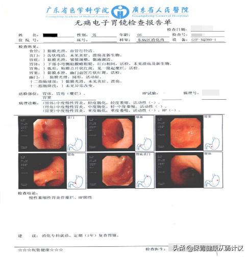 萎缩性胃炎你需要知道的5个点,萎缩性胃炎很吓人看完你就懂了