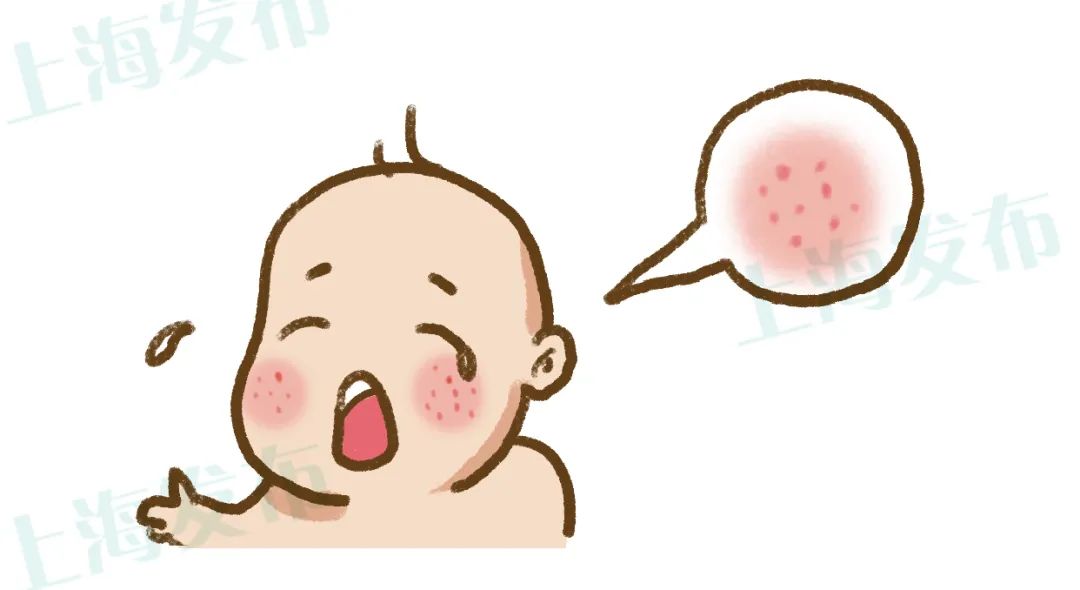 湿疹的克星你知道是什么吗,湿疹是免疫系统出了什么问题