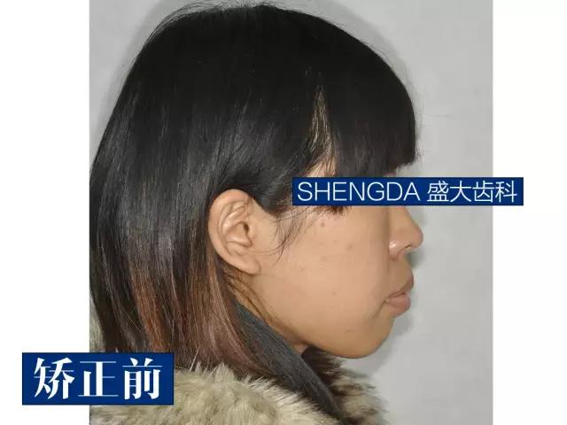 山西“爱马仕”级别齿科医院！get明星同款笑容