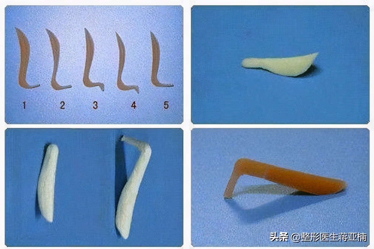 怎么判断隆鼻假体歪了,假体隆鼻切口外露修复