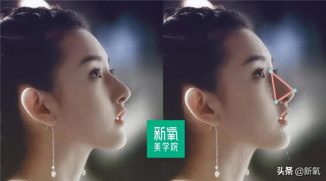 短翘鼻漂亮女星,小翘鼻适合方形脸