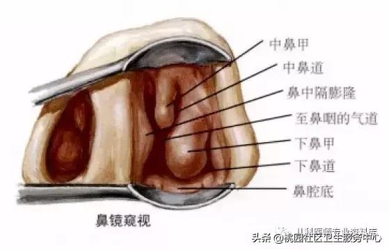 过敏性鼻炎手术的全过程,治疗过敏性鼻炎有效的药