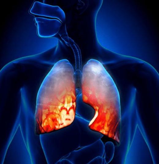 吸烟突然把烟戒了是好事吗,长期吸烟的人突然戒烟反而更伤肺