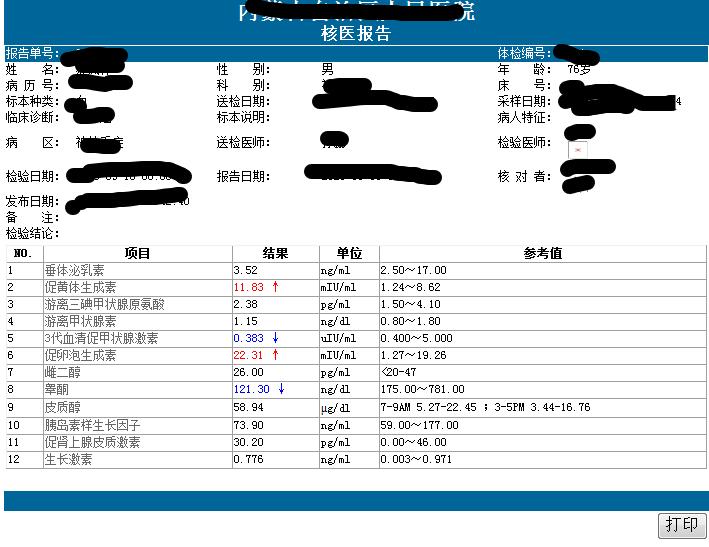 眼突然模糊看不清与大脑有关吗,长时间看不清东西眼睛会变小吗
