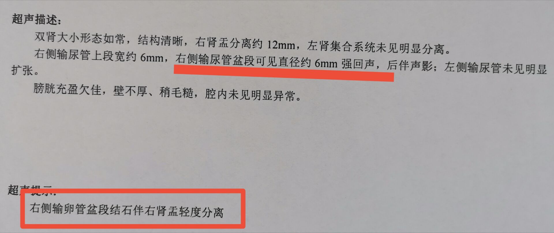 输卵管结石吃什么药排得快,男人输卵管结石怎么治愈