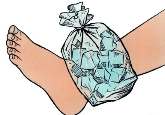 踝关节扭伤康复方法图片,踝关节扭伤弹力带康复