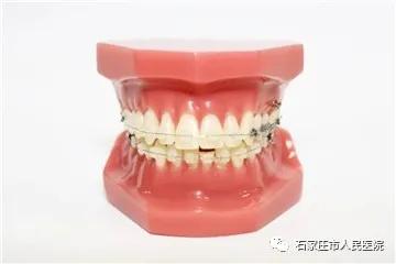 告诉你个秘密，“无齿”的原因是……