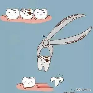 2020牙齿矫正攻略请查收,今日头条修复牙齿