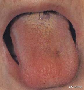 最实用的舌诊图六大舌象,舌诊深入学习书