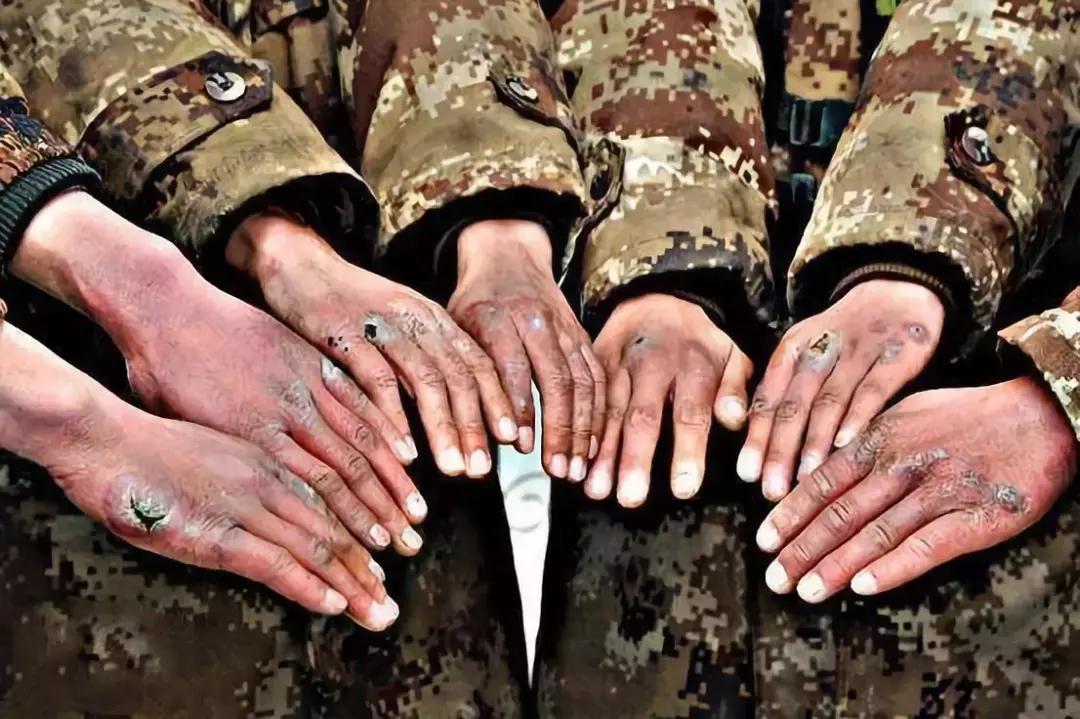 书里说的古代冬天打仗士兵冻掉手指头是真的吗？