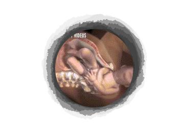 剖腹产宝宝自己从肚子里爬出来?分娩的时候宝宝和你一起在努力