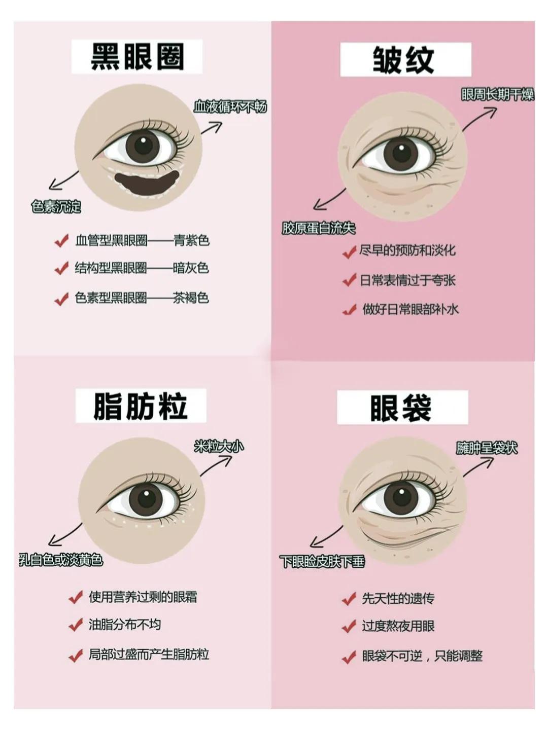 黑眼圈脂肪粒和细纹,一招解决眼袋黑眼圈眼角纹