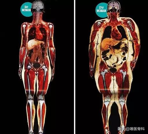 长腿秘诀大全图解,原来大长腿是这样炼成的