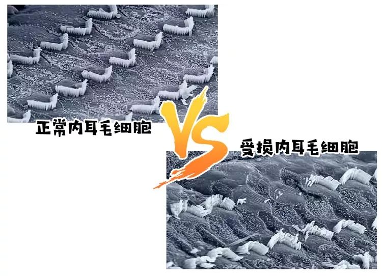 神经性突发性耳聋可以戴耳机吗,经常戴耳机耳朵听力下降怎么办