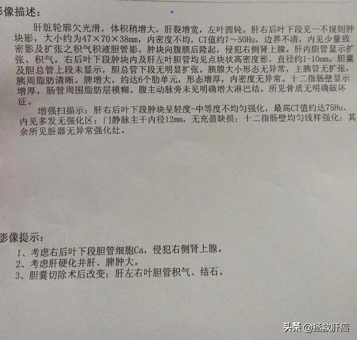 结节到底会不会变癌,结节癌变都是早期的吗