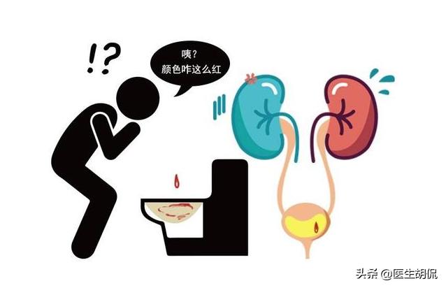 膀胱癌十大恶性肿瘤之一！早起出现4个症状，最好检查下