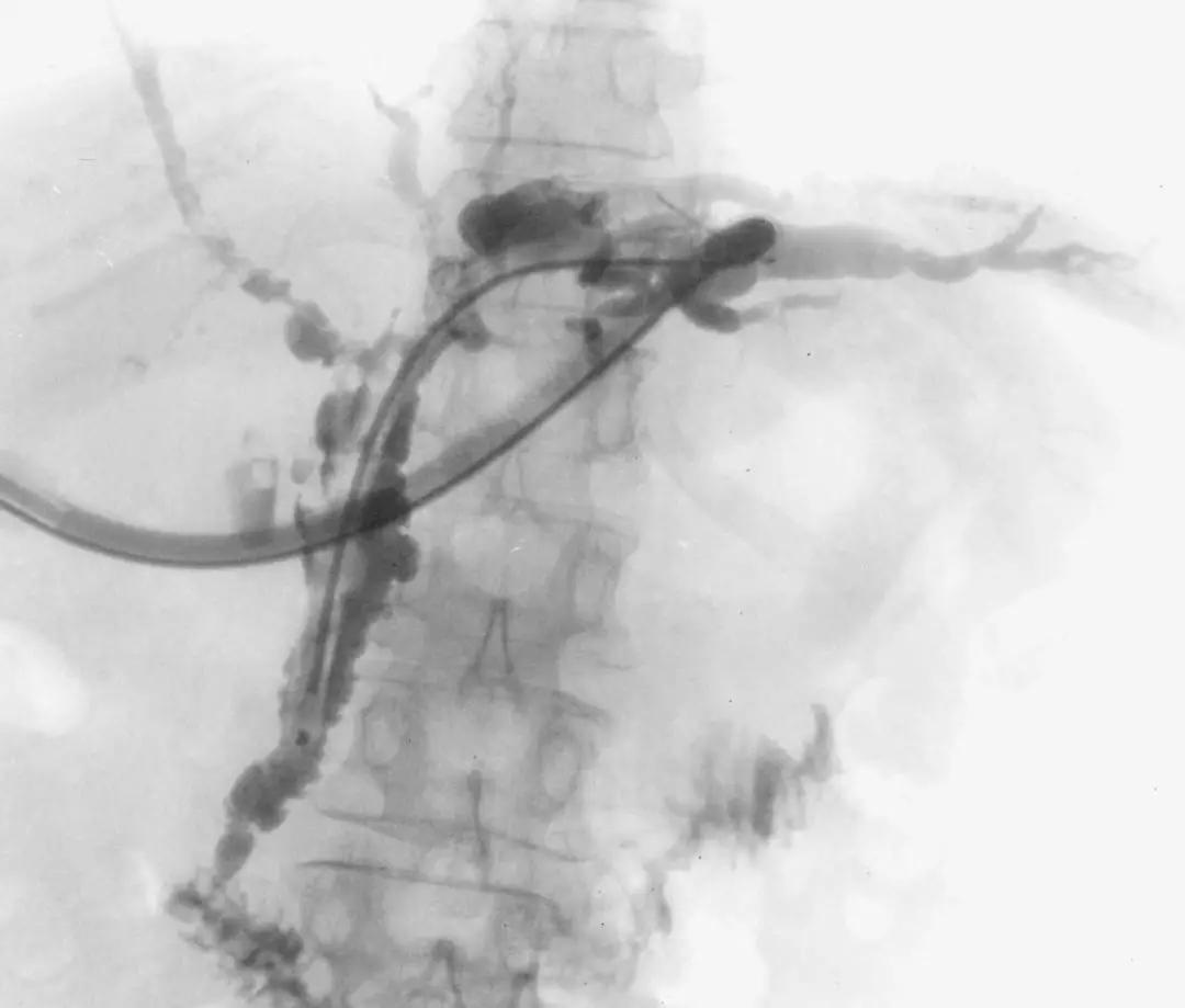 ps所有疑难杂症,ps疑难杂症