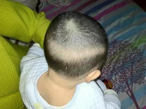 25天新生儿缺钙怎么补,新生儿缺钙