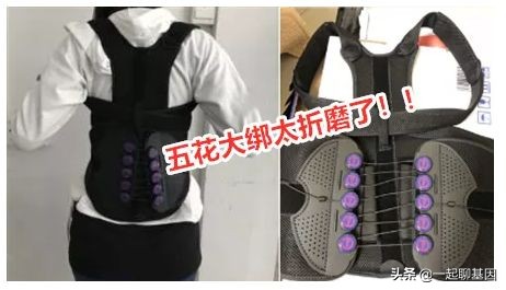 驼背怎么办最有效的方法,驼背怎么矫正最有效方法