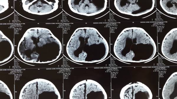 医生说怀孕了有没有可能错了,医生说怀孕有风险