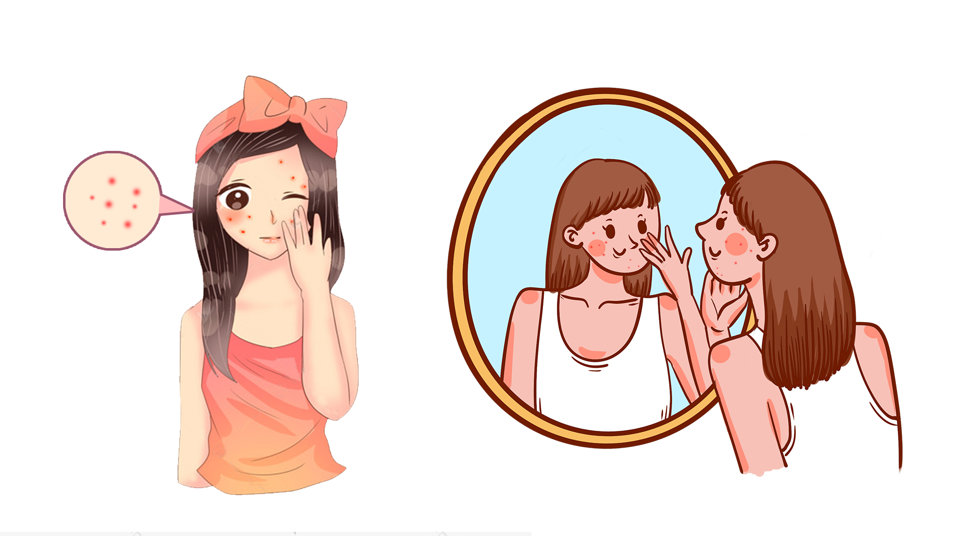 孩子青春期长痘痘，家长不要不在意，这些小技巧帮助您