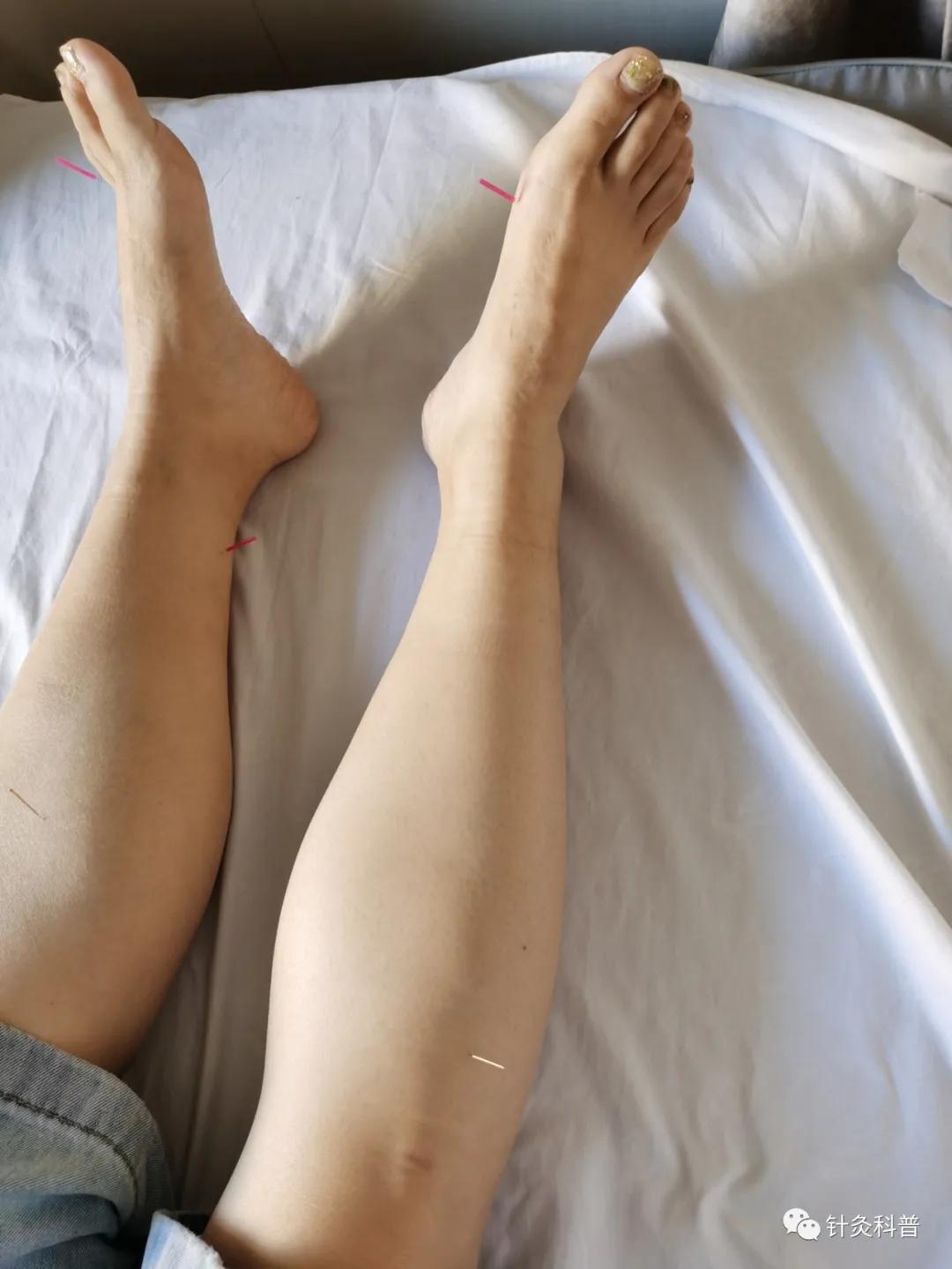 脉诊针灸视频教程,脉诊针灸穴位