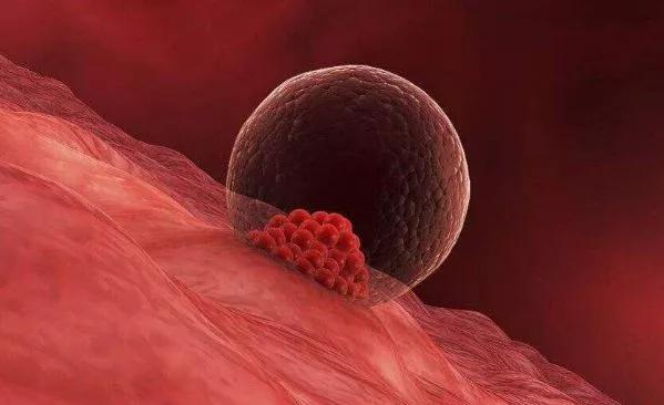 卵泡监测，到底有多重要？