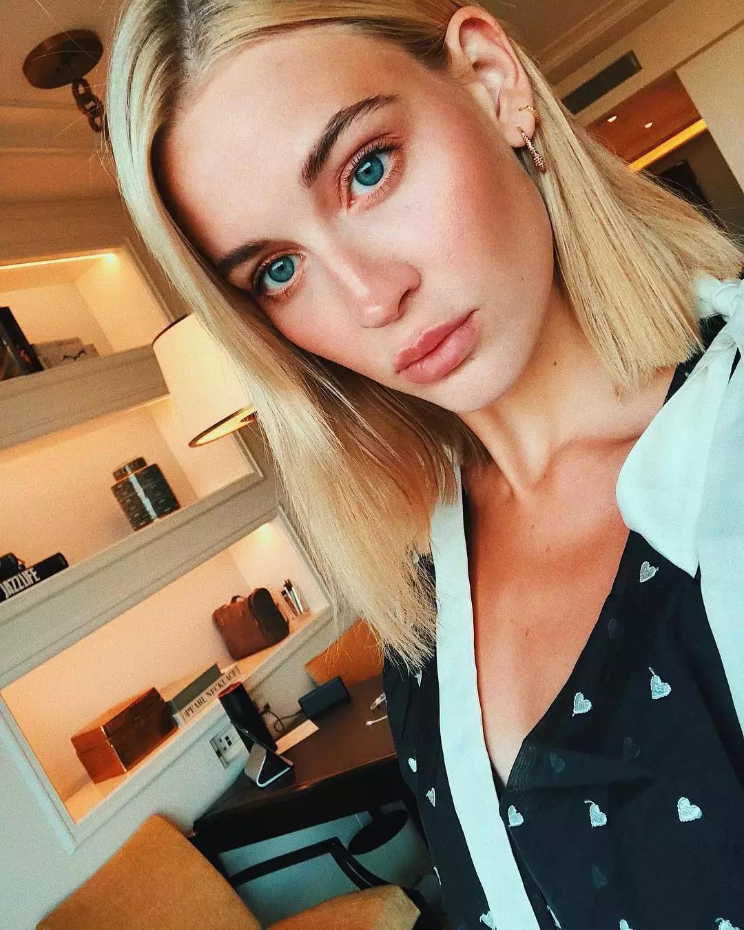 假期过后祛痘,假期祛痘攻略