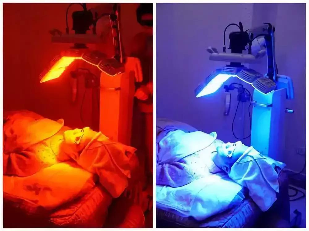 怎样改善油性皮肤问题,怎样改善油性皮肤长痘