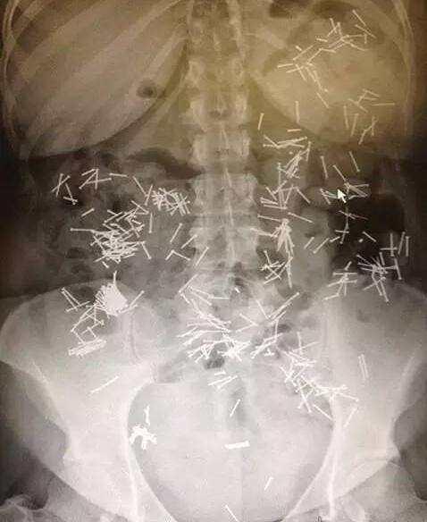 不作死就不会死看看你中了几条,不作死就不会死让人看的头皮发麻