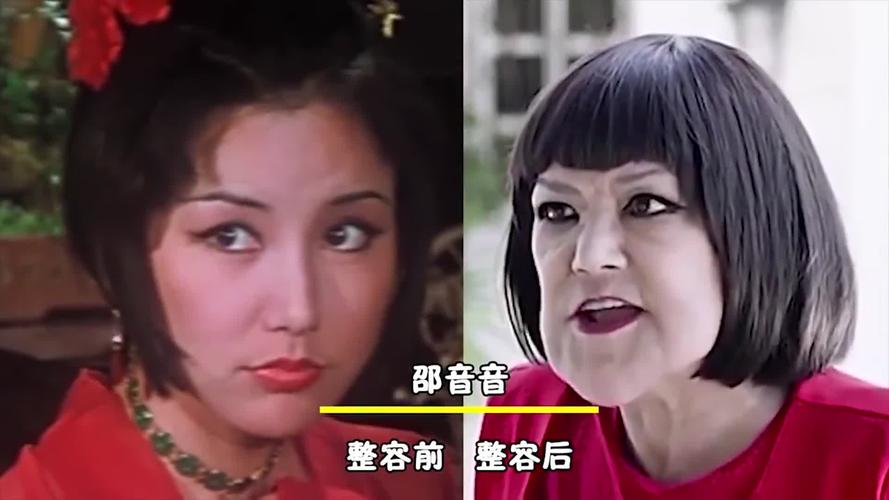 10位被整形毁掉的女星,被整容毁掉的女明星