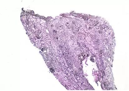 肾毒性食物一览表,肾毒性的药物排名