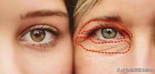 用什么样的眼霜可以缓解泪沟眼袋,眼袋和泪沟用眼霜效果好吗