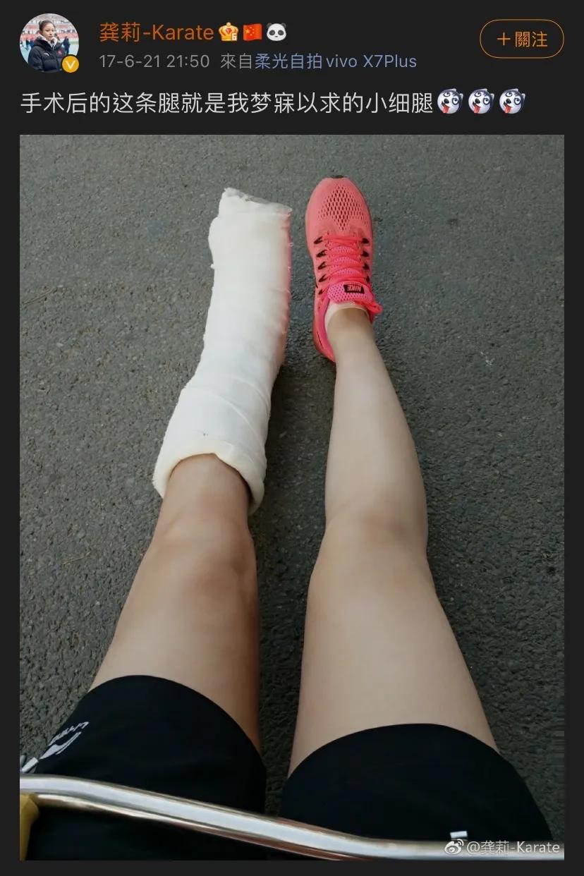 这样的“*力暴**萝莉”，丑吗？