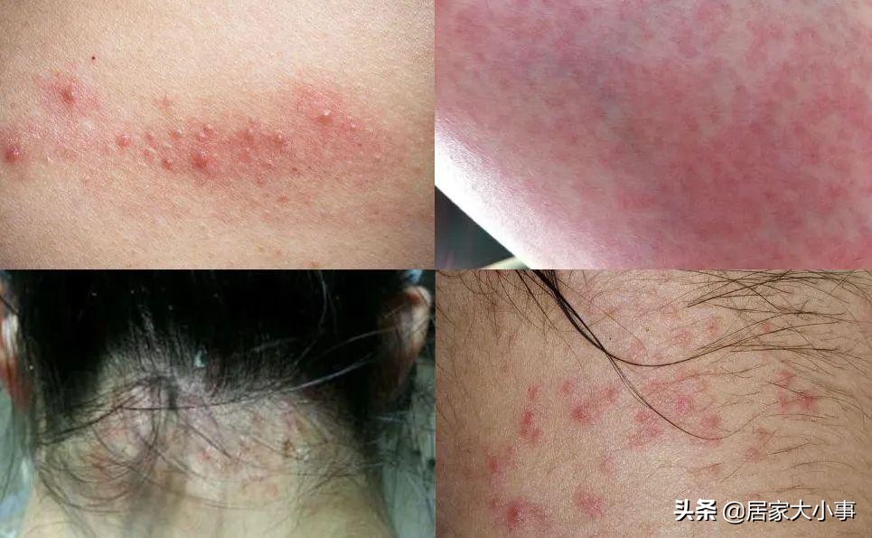 热卖搓澡巾,强力搓泥搓澡巾包邮