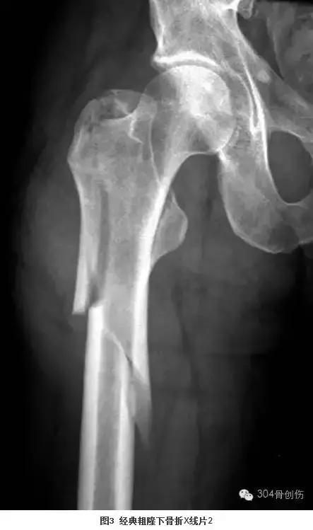 循证医学学习指导,循证医学连续病例