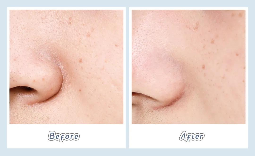 homefacialpro清洁面膜,6款超火清洁面膜测评