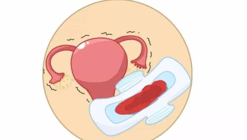 排卵期出血是怎么回事,更年期排卵期出血需要治吗