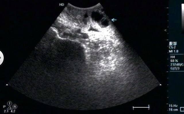 辟谷是什么都不吃么,辟谷是什么意思是不吃饭吗