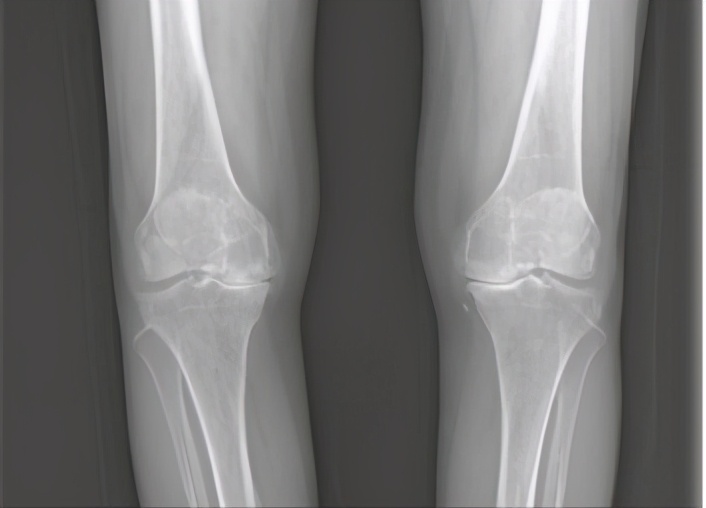 膝盖痛12种疼痛对照表图解,不同部位膝盖疼痛的原因