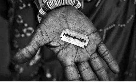 熨平少女胸部！揭秘非洲可怕习俗“烫乳”