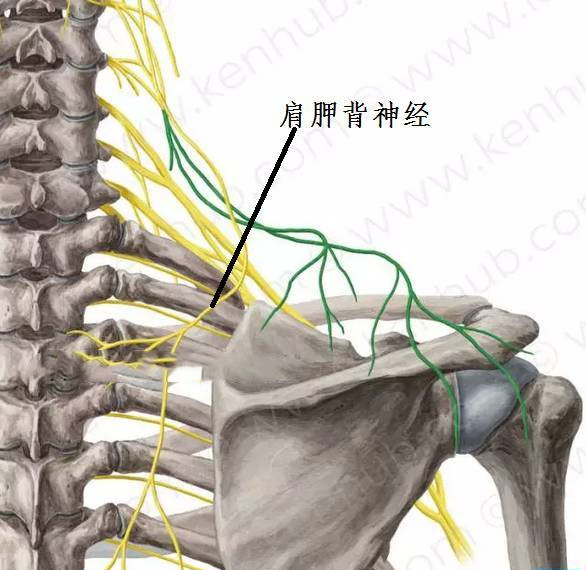 肩胛背神经卡压的病因,肩胛背神经卡压来自哪里