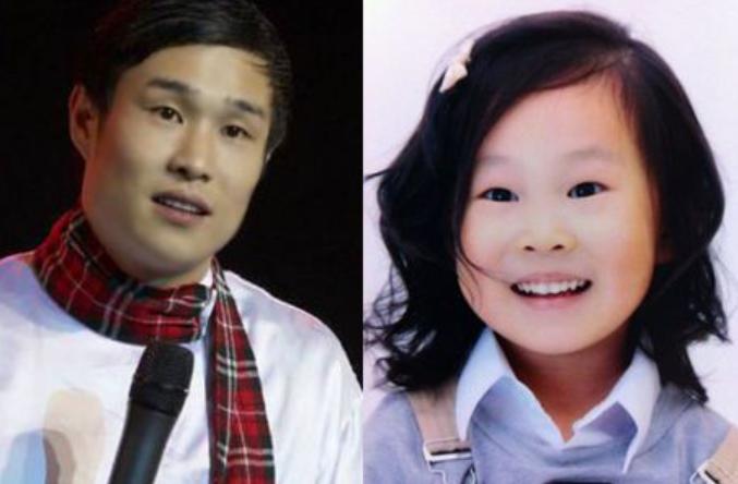 孕妇有黑眼圈会遗传给孩子吗,黑眼圈会遗传给孩子吗