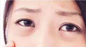 眼霜如何挑选先来看看这篇干货,眼霜排名十大公认好用的眼霜测评