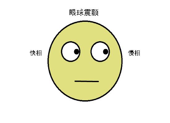 正常眼位和斜视眼位,斜视眼的几大症状