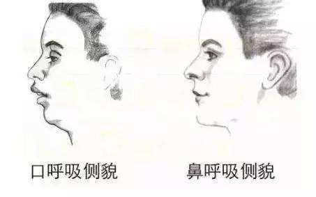 充足的睡眠才是最好的美容,美容睡眠的正确方法