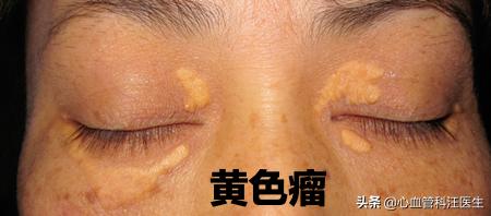 一个发霉的橘子热评,一个发霉的橘子