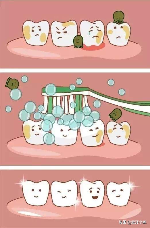 2岁宝宝牙齿坏掉视频,2岁宝宝牙齿坏的只剩牙根怎么办